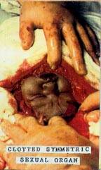 Clotted Symmetric Sexual Organ : Demo 97